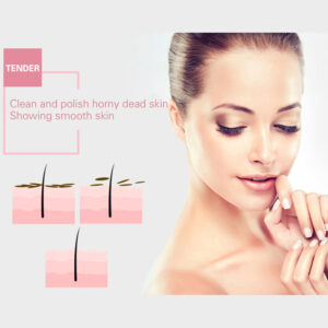 Blackhead Remover | Face Acne Black Dot Pimple Electric Blackhead Vacuum Cleaner | Pore Skin Care Tools Machine
